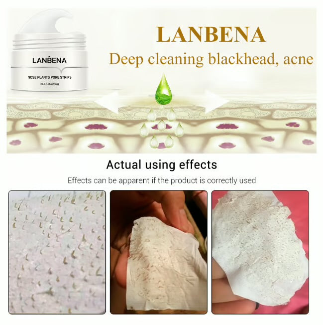 LANBENA™ Crème Anti-Points Noirs et Impuretés - Votre secret pour une peau éclatante